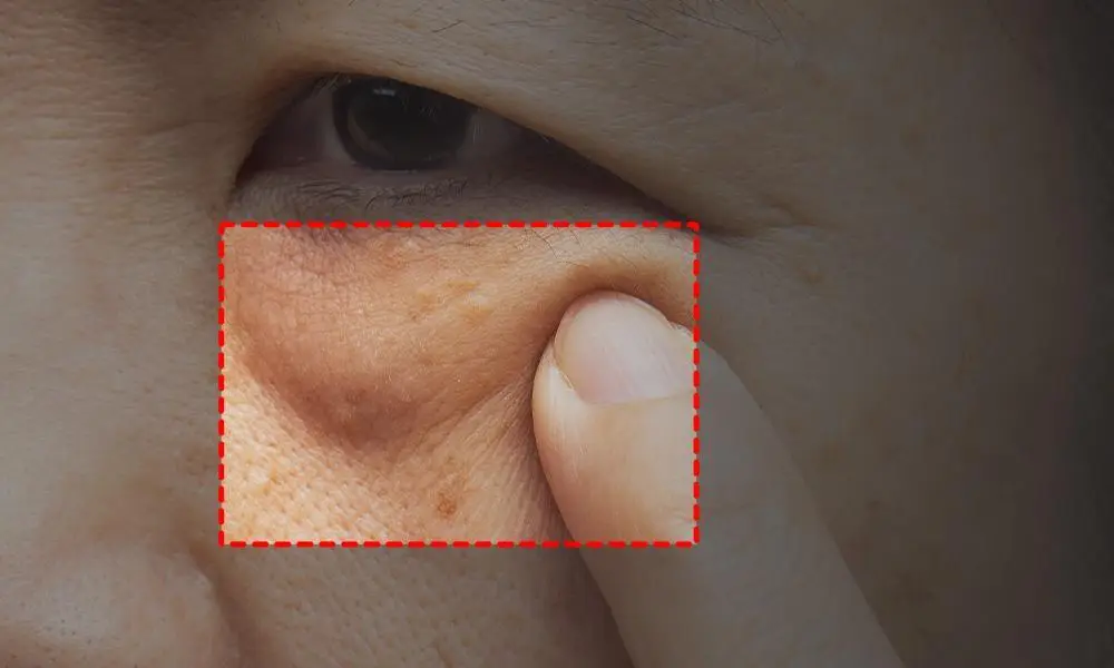[아이백볼륨UP/주름개선] 성분에디터 실크펩타이드 인텐시브 리프팅 아이크림 30ml 상세페이지 16